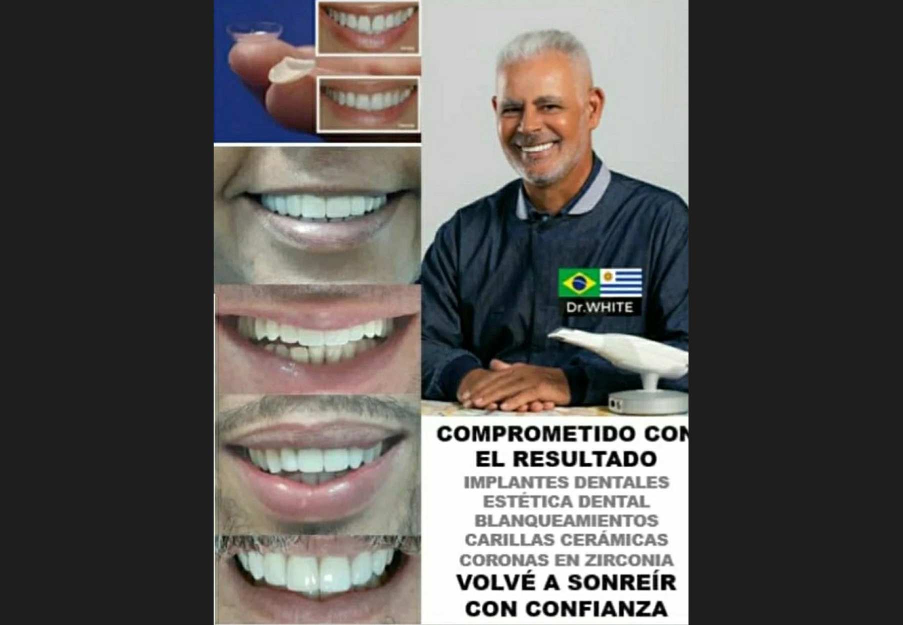 Dr. White Implantes Dentales showing before-and-after dental implant and aesthetic restoration results with patient smiles and the dentist portrait.
