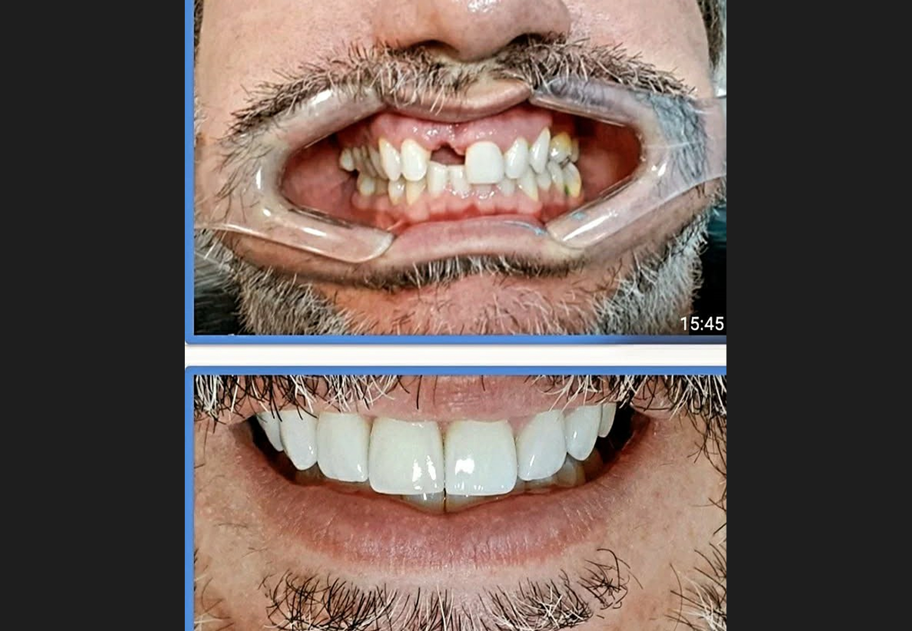 Dr. White Implantes Dentales showing before-and-after dental implant and aesthetic restoration results with patient smiles.